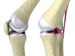 மனித உடலைப் பற்றிய சில சுவாரஸ்ய தகவல்கள்!!! 03-1404372352-23-bone