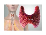Ways Treat Hypothyroidism Naturally
