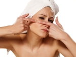 Have Acne Prone Skin Remember These