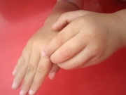 10 Common Allergy Triggers