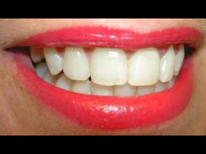 Teeth Care Tips