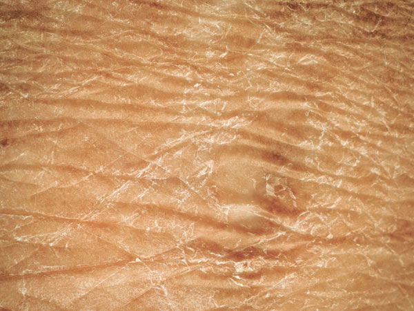 அழகைக் கூட்டும் பலாப்பழ ஃபேஸ் பேக்குகள்!!! 03-1372843870-9-dryskin