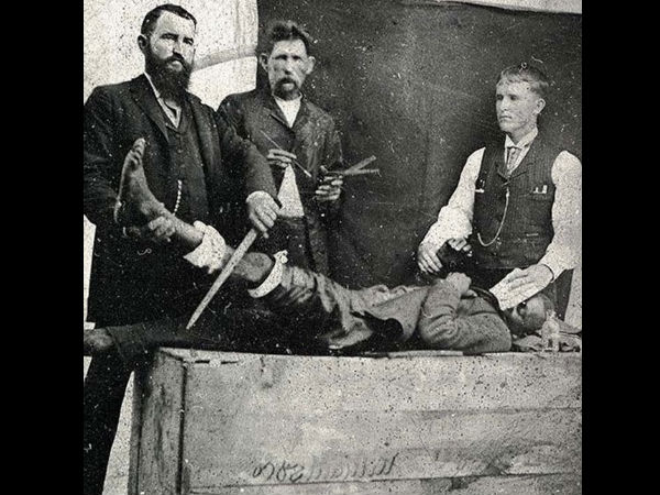 10-1436503703-18creepyvintagemedicalphot