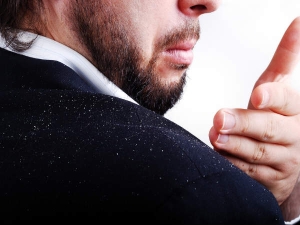 Top 10 Natural Remedies For Dandruff
