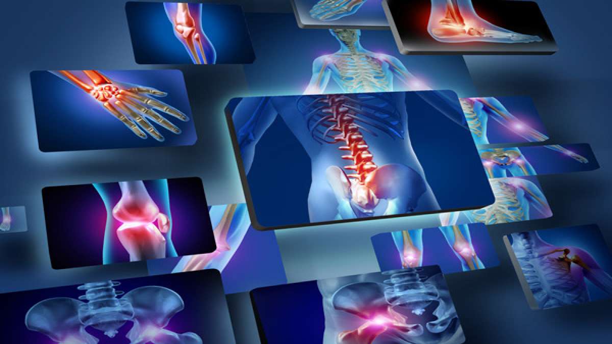 ஆர்த்ரிடிஸ், ஆஸ்டியோபோரோசிஸ் பிரச்சனைகளில் இருந்து விடுபட வேண்டுமா