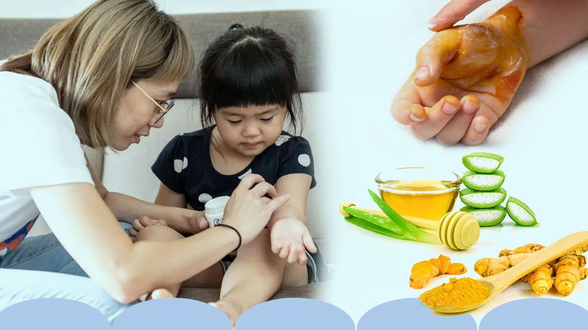 சிறிய வெட்டுக்காயம் & தீக்காயம் ஏற்பட்டால் கிச்சனிலுள்ள இந்த 5 பொருட்கள