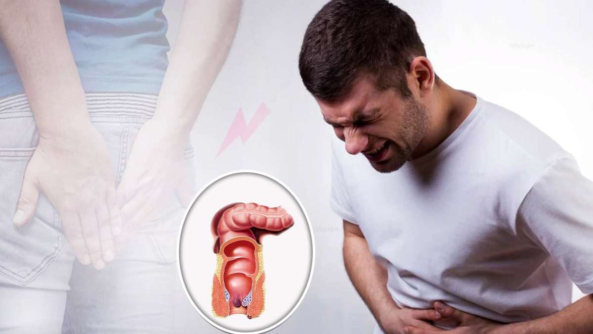 உங்களை பாடாய்படுத்தும் பைல்ஸ் பிரச்சினை உங்களுக்கு வரக்கூடாதா? அப்ப