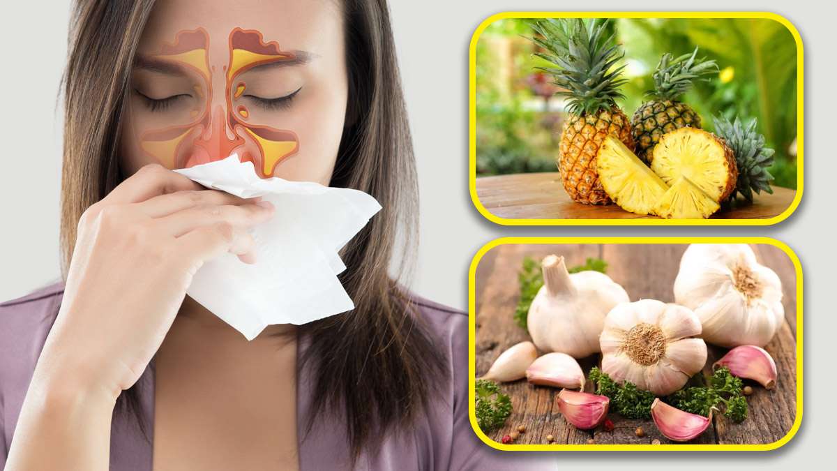 சைனஸ் பிரச்சினை இருக்கா? அப்ப இந்த உணவுகளை எடுத்தா பிரச்சினை உடனே