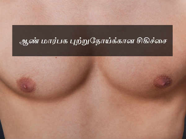 ஆண் மார்பக புற்றுநோய்க்கான சிகிச்சை