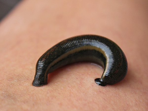 அட்டைப் பூச்சி தெரபி கேள்விப்பட்டிருக்கிறீர்களா? | How is leech therapy ...