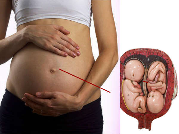 கர்ப்பிணி மற்றும் தாய்மார்கள் :