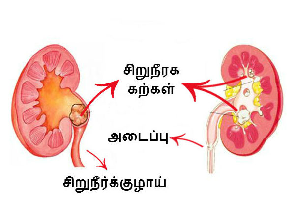 கற்கள் எப்படி வருகிறது..?
