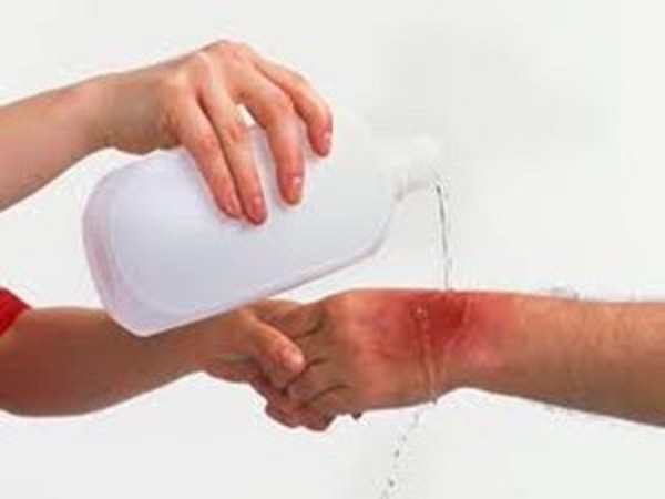 காரணங்கள்