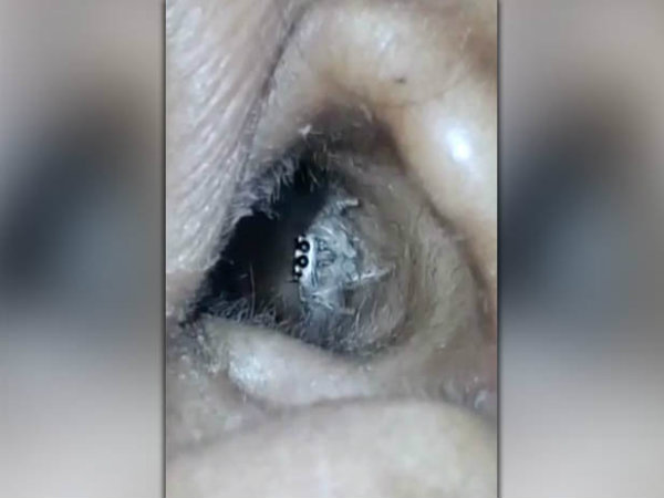 காதில் பூச்சி