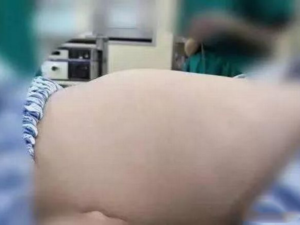 முடியை சாப்பிடுகிறாள்