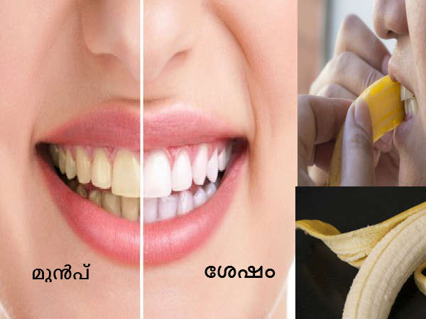 வெண்மையான பற்கள்