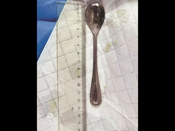 மீன் முள்ளை அகற்ற