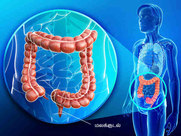 காரணங்கள்