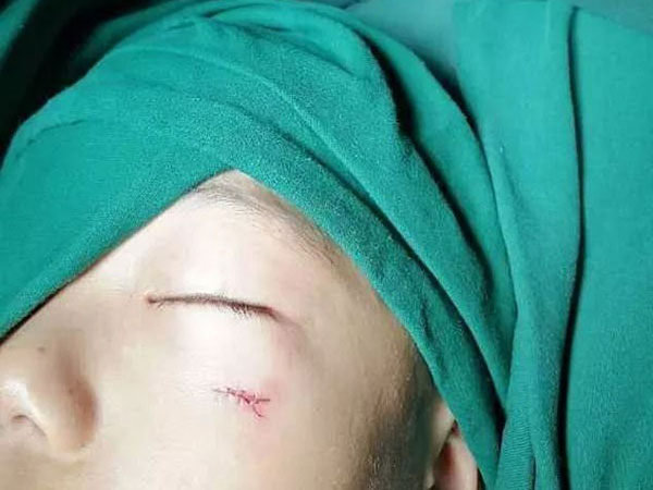 அறுவை சிகிச்சை மூலம் பென்சிலை எடுத்தல்