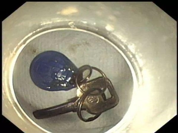 மார்பகத்தில் வலி