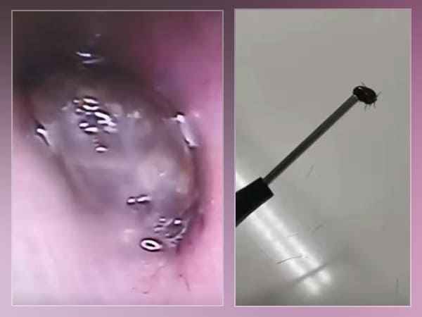 பெண்ணின் அதிர்ஷ்டம்