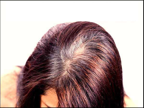 கட்டுக்கதை எண் 2.