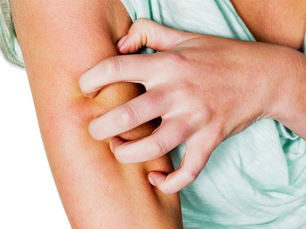 சொறி சிரங்கிலிருந்து பாதுகாக்க