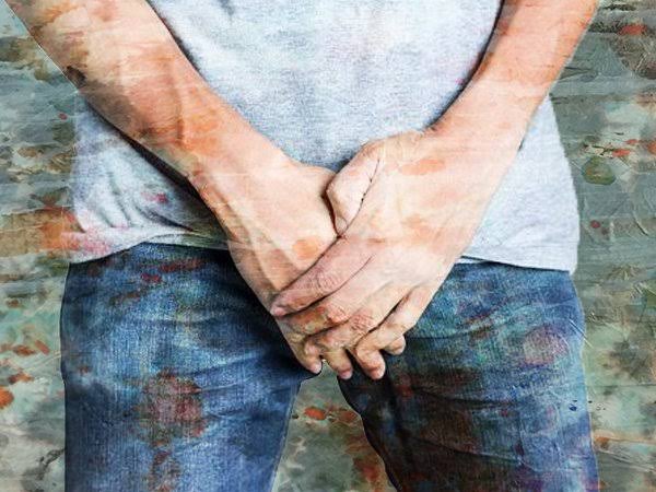 ஆண்குறி ஒவ்வாமைக்கு சிகிச்சையளிப்பது எப்படி