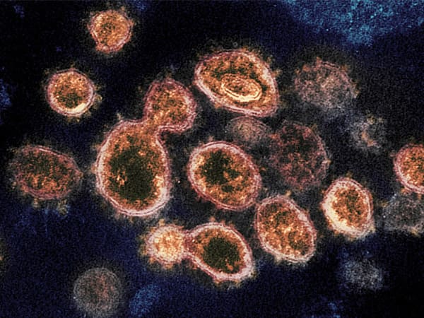 H5N1 - பறவைக் காய்ச்சல்