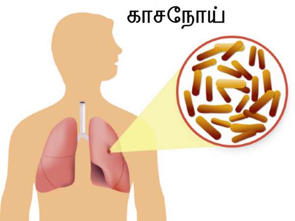 காற்றில் பரவும் நோய்கள்: