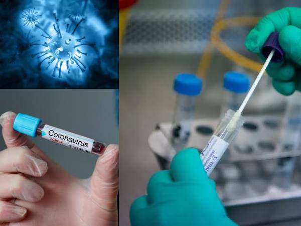துணியால் துடைக்கும் சோதனை சரியாக நிர்வகிக்கப்படாமல் இருப்பது
