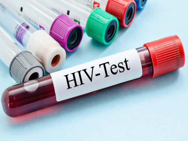HIV மற்றும் STDs