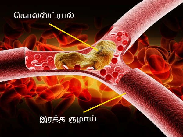 யாருக்கு இதன் அபாயம் அதிகம் உள்ளது?
