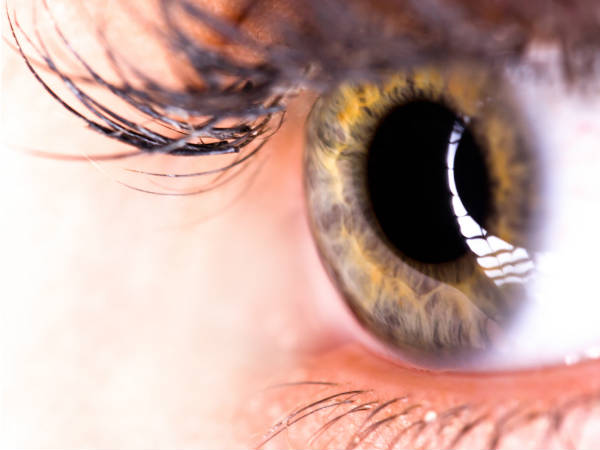 மாகுலர் சிதைவு (Macular degeneration)