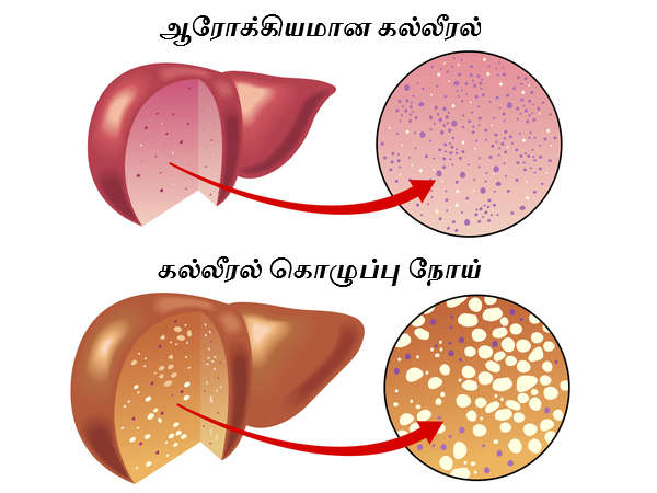 முடிவு