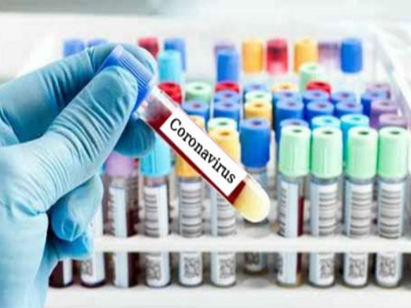 நெகட்டிவ் ரிசல்ட் வந்தாலும் கவனிக்க வேண்டிய அறிகுறிகள்