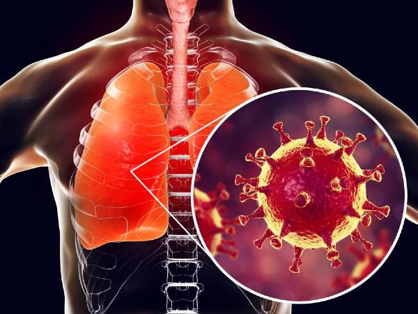 உங்களுக்கு இந்த அறிகுறிகள் இருந்தால் கொரோனா உங்கள் நுரையீரலை தீவிரமாக தாக்கிவிட்டது என்று அர்த்தமாம்...!