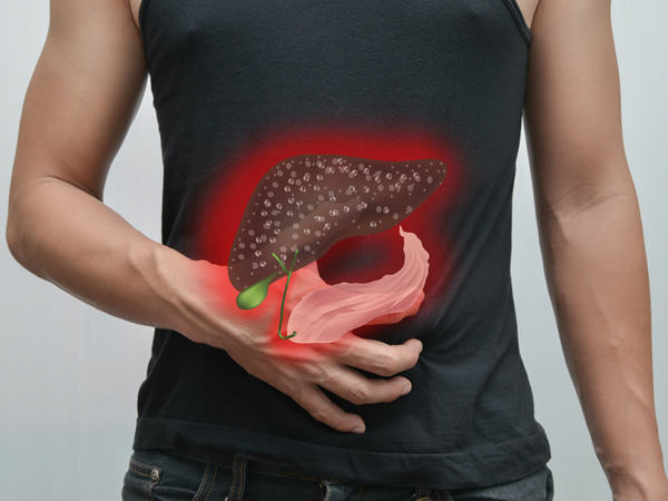 NAFLD இன் காரணங்கள்