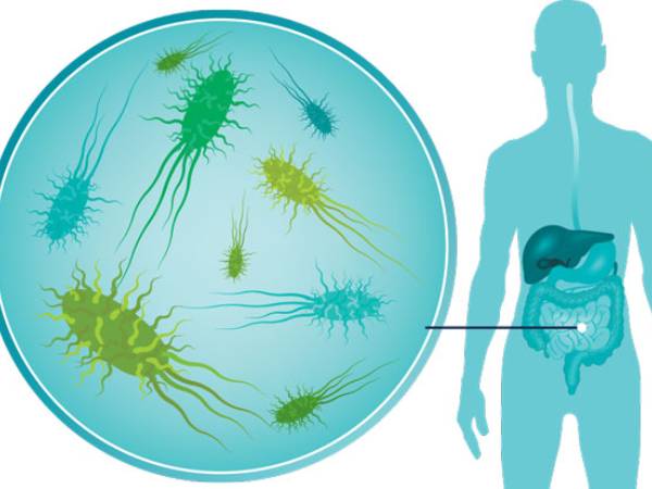 FODMAP குறைந்த உணவு முறையை ஏன் நிரந்தரமாக பின்பற்ற முடியாது?
