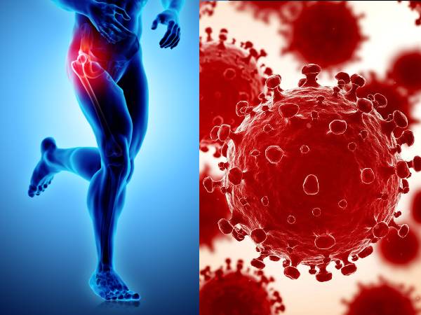 எச்சரிக்கை! கொரோனாவில் இருந்து குணமானவர்களுக்கு வரும் புதிய எலும்பு இறப்பு நோய்... அறிகுறிகள் என்ன?