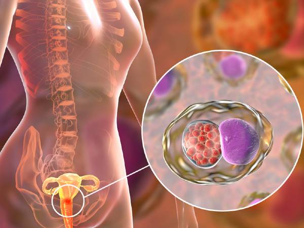பெண்களே! உங்களுக்கு 'இந்த' அறிகுறிகள் இருந்தால் உங்க உயிருக்கே ஆபத்தாம்...ஜாக்கிரதை...!