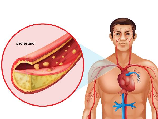 உங்கள் இரத்தத்தில் அதிகமாக இருக்கும் கொழுப்பை கரைக்க இதில் ஒன்றை தினமும் குடிங்க போதும்...!