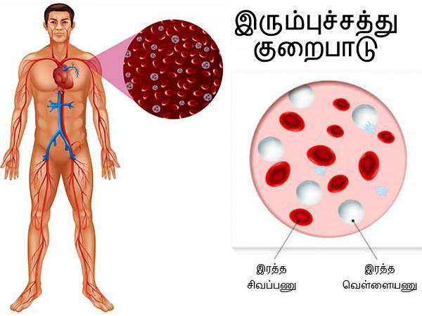இரும்புச்சத்து குறைபாடு
