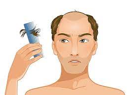 உங்களுக்கு முடி உதிர்வு அதிகமாக இருக்கா? அப்ப இந்த ஆரோக்கிய பிரச்சினைகள் இருக்க வாய்ப்பிருக்காம்... உஷார்!