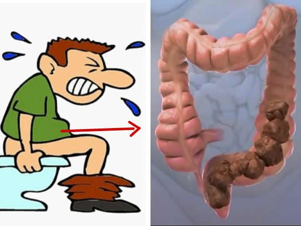 மலம் கழிக்கும் போது நீங்க 'இப்படி' உணர்கிறீர்களா? இது ஆபத்தான புற்றுநோயோட அறிகுறியாம் தெரியுமா?