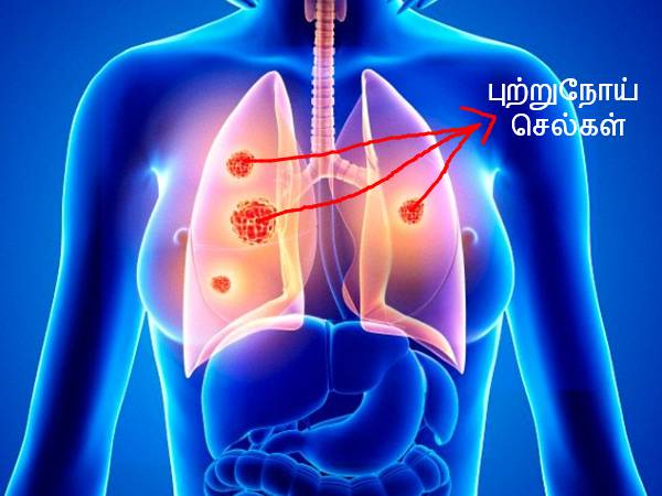 உங்களுக்கு காலை எழுந்தவுடன் இந்த பிரச்சினை இருந்தால் உங்களுக்கு புற்றுநோய் இருக்க வாய்ப்பிருக்காம்..!