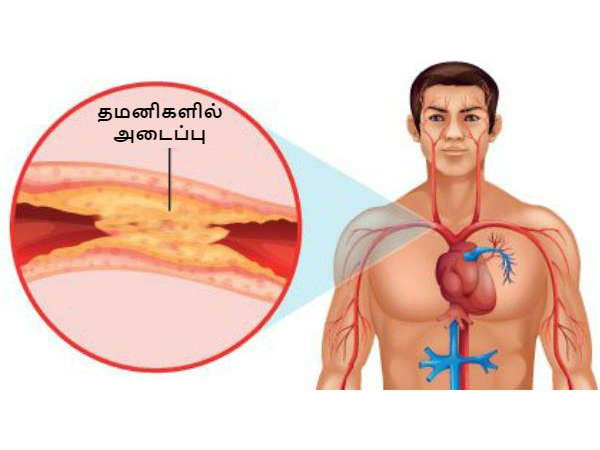 இந்த உணவுகளுக்கு உடனே குட்-பை சொல்லுங்க.. இல்லன்னா கொழுப்பு தேங்கி சீக்கிரம் மாரடைப்பு வந்துடும்...