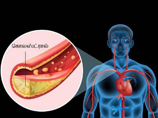 கொலஸ்ட்ரால் உண்மை உயிருக்கு ஆபத்தை ஏற்படுத்துமா? ஆய்வு சொல்லும் அதிர்ச்சி முடிவு என்ன தெரியுமா?