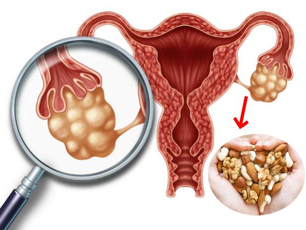 மாதவிடாய் தாமதத்துடன் தொடர்புடைய பொதுவான நோய்கள்
