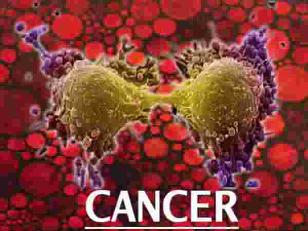 ஆண்களிடம் இந்த அறிகுறிகளில் ஒன்று இருந்தாலும் அவங்க புற்றுநோய் ஆபத்தில் இருக்கிறார்கள் என்று அர்த்தம்... உஷார்